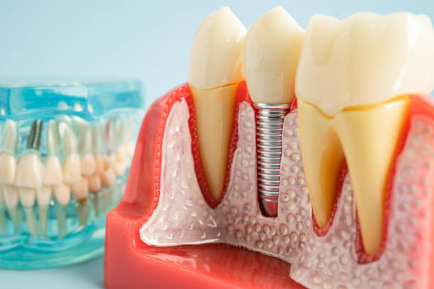 Our Range of Dental Services in Cedar Hill, TX